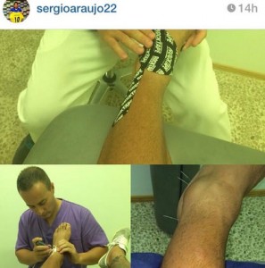 Sergio Araujo colgó esta imagen en Instagram en el día de ayer sobre su tratamiento